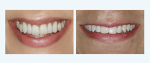 Smile Example Image