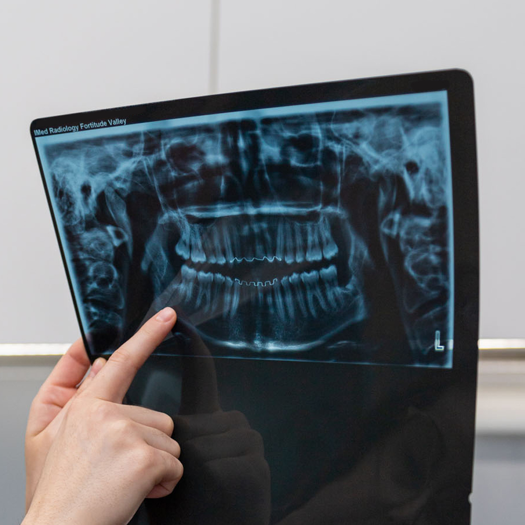 Dental X-Ray of Patients Teeth
